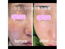 ココスタイルビューティー(COCOSTYLE beauty)の雰囲気（シミケアし放題）