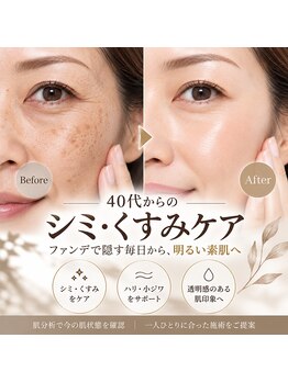 ミライ(Mirai)の写真/【40代からのシミ・くすみケア】ファンデで隠す毎日から、明るく自信の持てる素肌へ