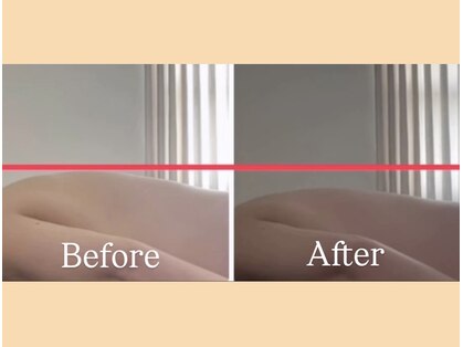 女性ホルモンケア専門サロンBalanceの写真