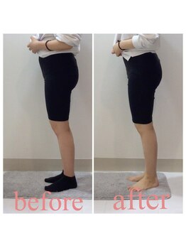 スタイルラボ高松/産後骨盤矯正の効果♪