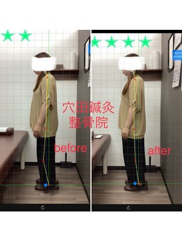 穴田鍼灸整骨院/整体・骨盤・ねこぜ・まき肩矯正