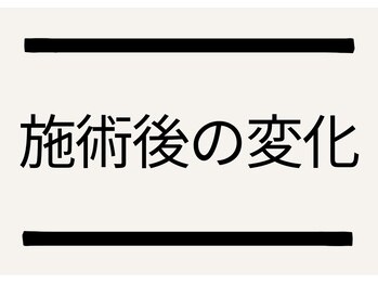 きずな鍼灸整骨院 武蔵ヶ丘本院/施術後の変化を紹介いたします
