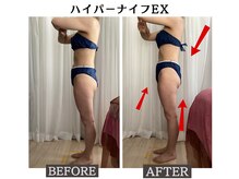 リヘッド(Re.head)/ハイパーナイフ　頑固な脂肪撃退