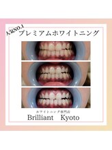 ブリリアント 京都店(Brilliant)/【大人気】6回コースの施術結果