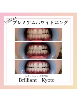 ブリリアント 京都店(Brilliant)/【大人気】6回コースの施術結果