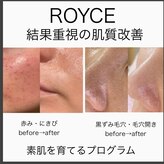ロイズ(ROYCE)