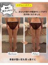 アイシー(I Sea)/バザルトボディ