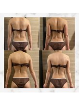 エムズ ビューティー サロン(M's Beauty Salon)/ビフォーアフター