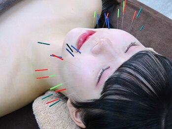 ヘルシースリムウエダの写真/《美容鍼×エステ》で美肌革命☆たるみ,ほうれい線ケアでリフトアップ/小顔へ見た目印象◎自信ある素顔へ♪