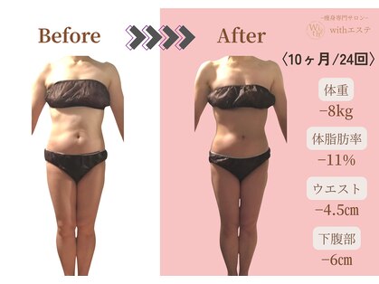 ウィズエステ(withエステ)の写真