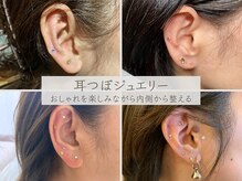ルアイナ 吉祥寺(Ruaina)の雰囲気(耳つぼを刺激して、耳からおしゃれに整える耳つぼジュエリー)