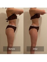 デッサン(dessin)/一回の施術でも効果大！