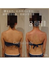 カルナボディ(Carna body.)/肩こり・背中のハリやだるさにも