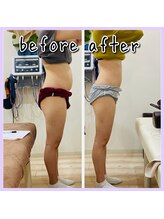 昭和区川名ひまわり接骨院/産後骨盤矯正×ダイエット【9】