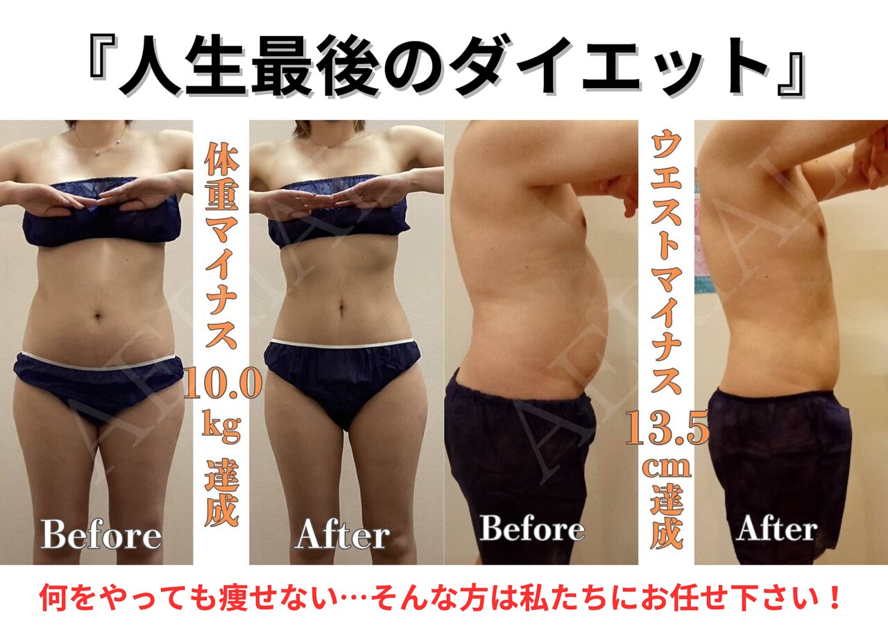 筑後市でEMSが人気のエステサロン｜ホットペッパービューティー