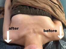 ラフェスタ ビューティー(Lafesta Beauty)/コルギ