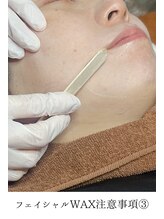 アマンビューティーリゾート/フェイシャルWAX注意事項3