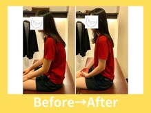 こころ整骨院/２0代女性のビフォーアフター