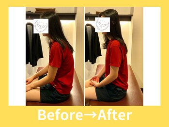 こころ整骨院/２0代女性のビフォーアフター