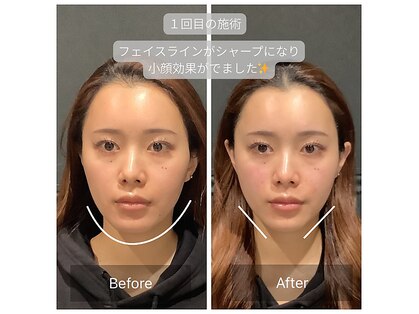 サリエ(S'allier)の写真