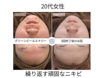 ビガク(BIGAKU)の写真