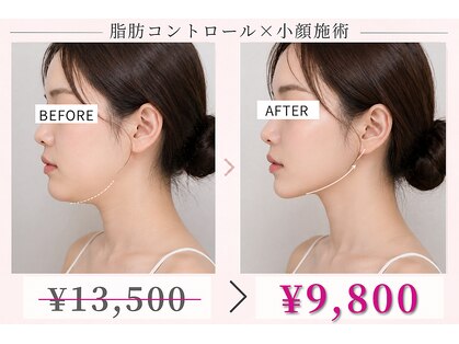 リレイスフクオカ(RelaceFUKUOKA)の写真