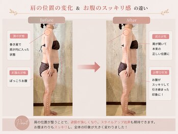 メデル(MEDEL)/巻き肩改善でバストアップ