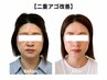 血流改善★ハイブリッド小顔コース(美腸ドリンク付き)　【通常60分】