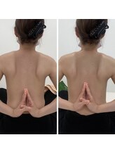 ソルニス(Solnis.)/痩身☆脂肪分解/ハイパーナイフ