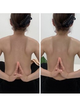 ソルニス(Solnis.)/痩身☆脂肪分解/ハイパーナイフ