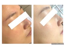 オアジスパ(Oasi Spa)/ノーファンデーション