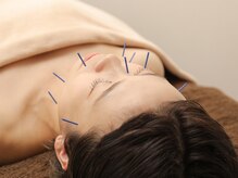 ハリキュア(H.a.r.i C.u.r.e.)/美容鍼