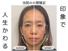 横浜駅きた西整体院/頭蓋骨小顔矯正整体6