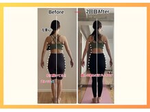 ラ キュート(LA-9TE)/美容矯正/姿勢改善/代謝改善