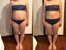 夏までに卒業！脂肪冷却1部位30分(脂肪分解マッサージ）+脂肪冷却アゴ　11000