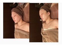 エステティックサロン 凜/韓国最新ピーリングララピール