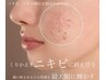 【ニキビ・赤み専門】肌質から整える大人ニキビ専門ケア/初回¥9900