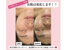 ディサイドロー(DECIDE L.A.W)/お客様と二人三脚！