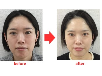 ブプラ 小倉店(BUPURA)/