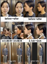 ドクターアーチ 神戸三宮 小顔矯正･整体サロン(Dr.ARCH)/ビフォーアフター