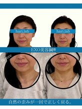 ハリラボ(hari Lab.)/【お客様の声】