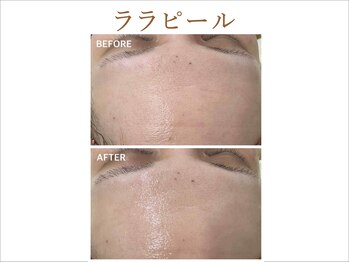 ティアム バイ テトテ 神戸三宮(TIAM by tetote)/ララピール