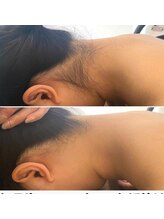 レイ(Rei)/ワックス脱毛も好評です