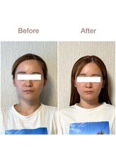 紡(TSUMUGU)/骨格補正スパ