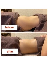 にこ。/子宮ケアのビフォーアフター