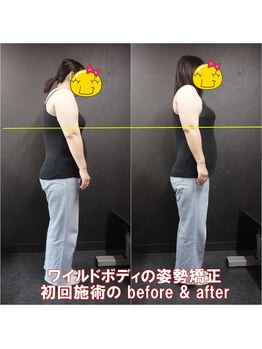 ワイルドボディ(WILD BODY)/姿勢矯正での改善例