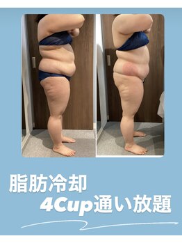 プリマプリート 可児店/脂肪冷却痩身!