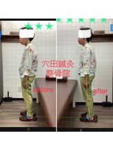 穴田鍼灸整骨院/整体・骨盤・ねこぜ・まき肩矯正