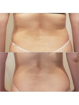 トータルエステティック ジョワイユ(JOYEUX)/120分の全身ケア&痩身