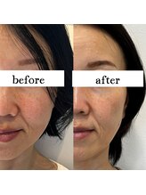 シーズボーテ(C's Beaute)/定期的ケアが結果を結ぶ